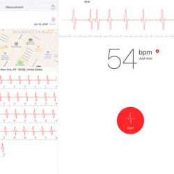 Download Cardiograph For iOS