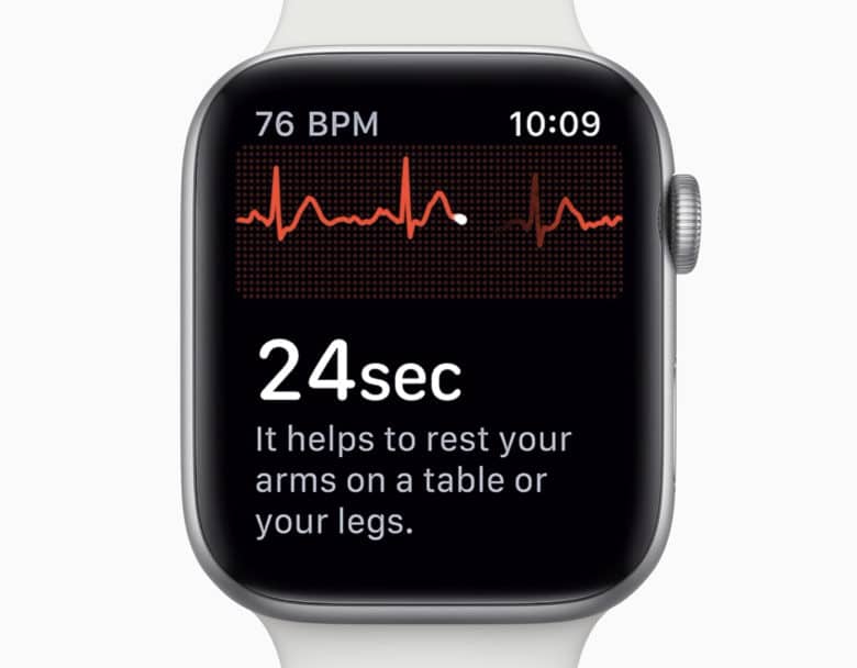 Apple could release apple watch ecg in europe any minute now 525435 2